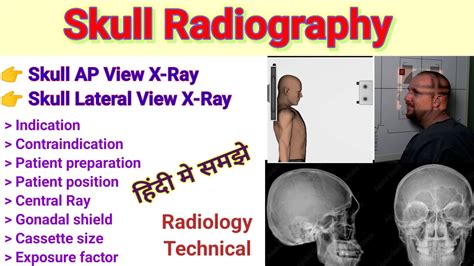 ap skull watch|ap skull positioning.